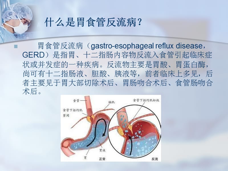 胃食管反流病健康教育ppt课件_第2页