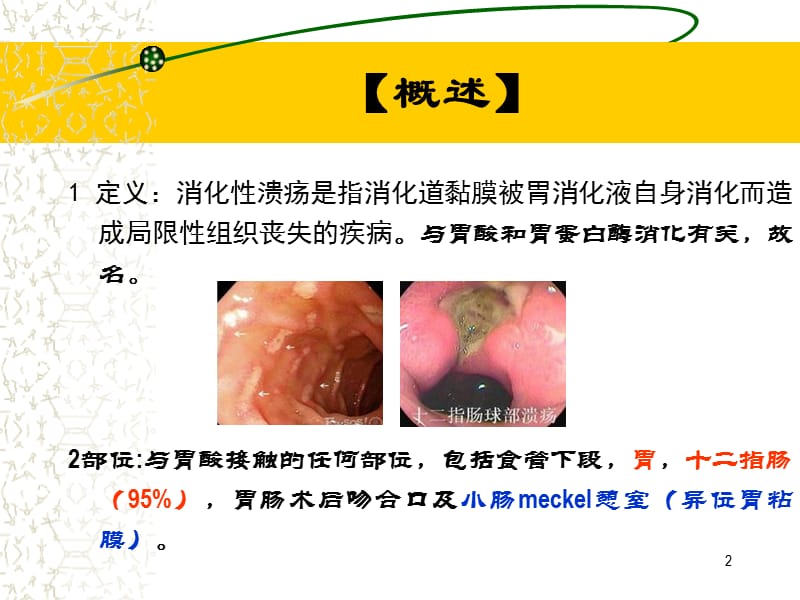 小儿消化性溃疡 ppt课件_第2页