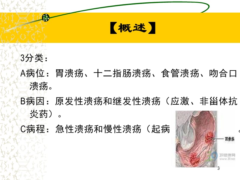 小儿消化性溃疡 ppt课件_第3页