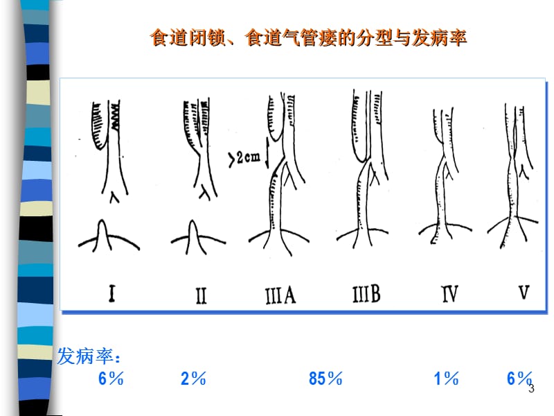 小儿先天性畸形的诊断与处理PPT课件_第3页