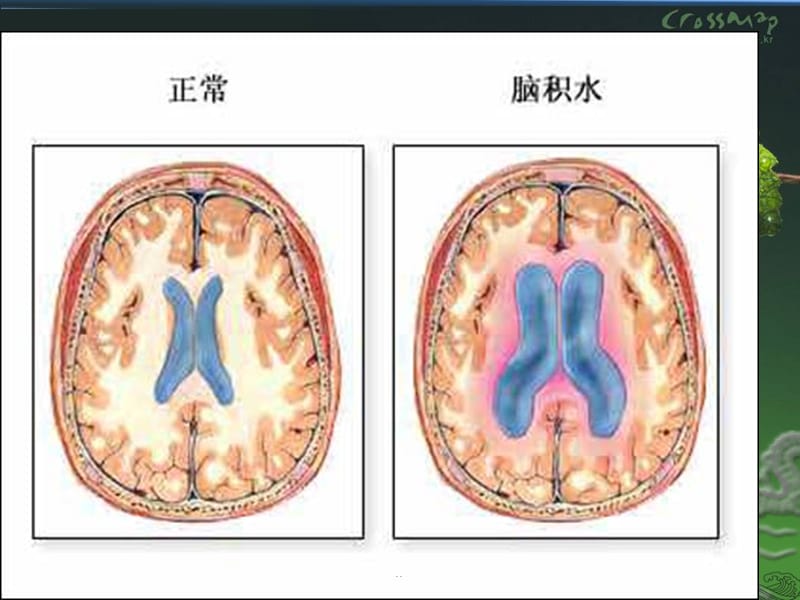 清洁养宫护理项目PPT演示课件_第3页