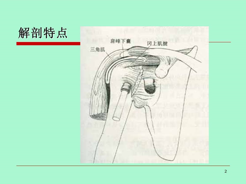 冈上肌腱炎PPT课件_第2页