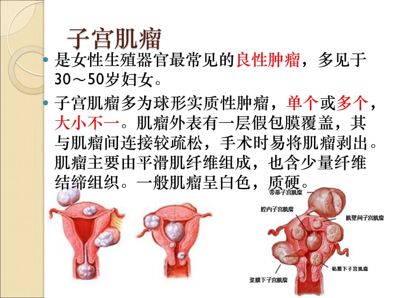 妇科常见疾病的临床特点PPT演示课件_第2页