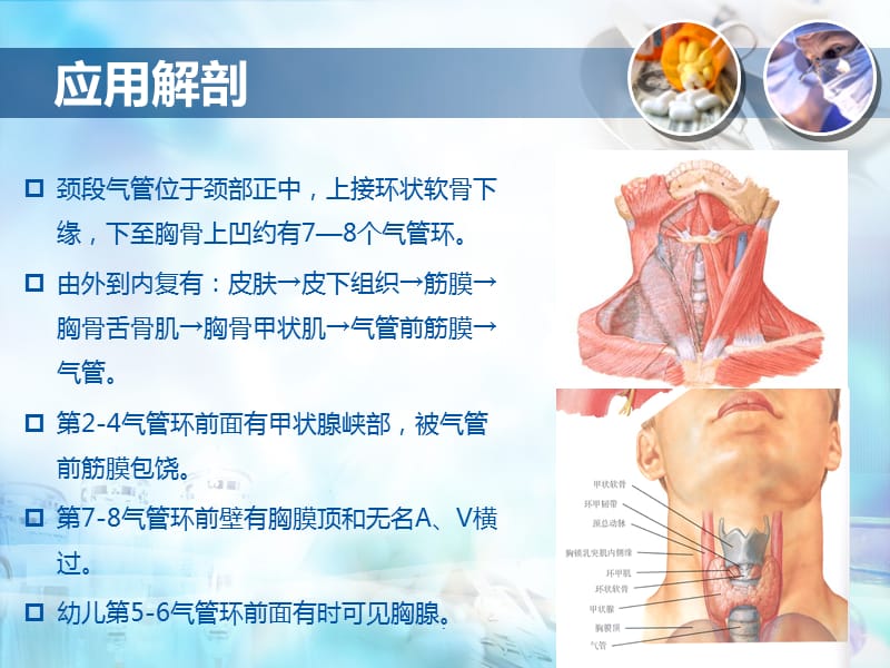 气管切开术PPT演示课件_第3页