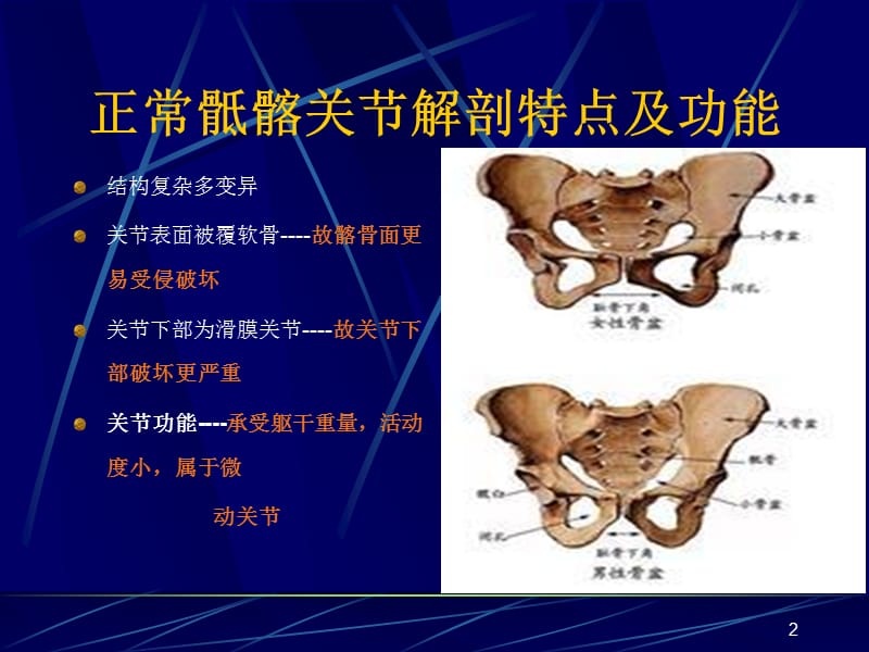 AS骶髂关节病变的CT诊断ppt课件_第2页