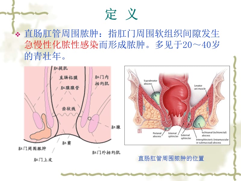 肛周脓肿PPT课件_第3页