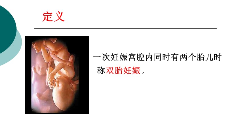 双胎妊娠PPT课件_第2页
