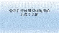 (醫(yī)學課件)骨惡性纖維組織細胞瘤ppt演示課件