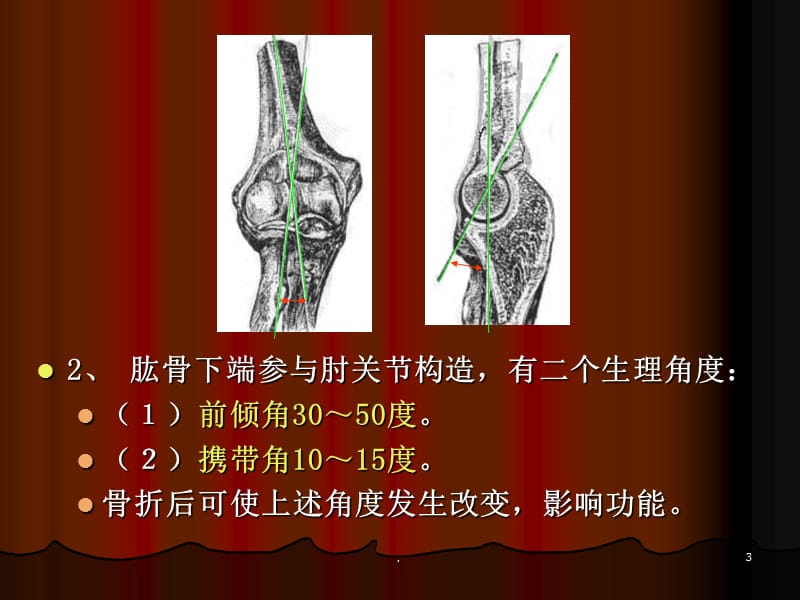(医学课件)肱骨髁上骨折ppt演示课件_第3页