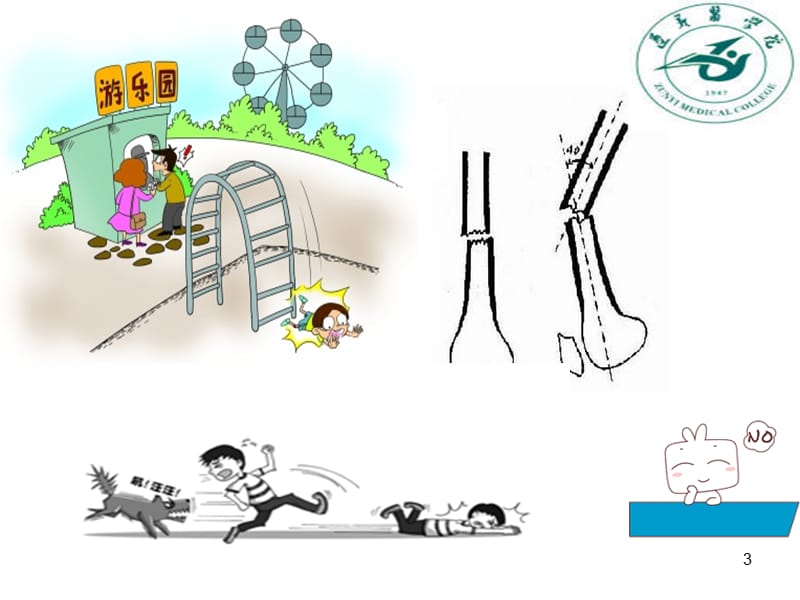 (医学课件)骨科 (2)ppt演示课件_第3页