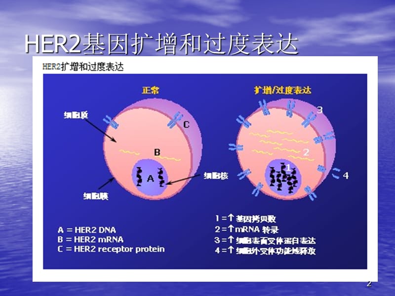 HER2基因检测在乳腺癌中的应用PPT课件_第2页