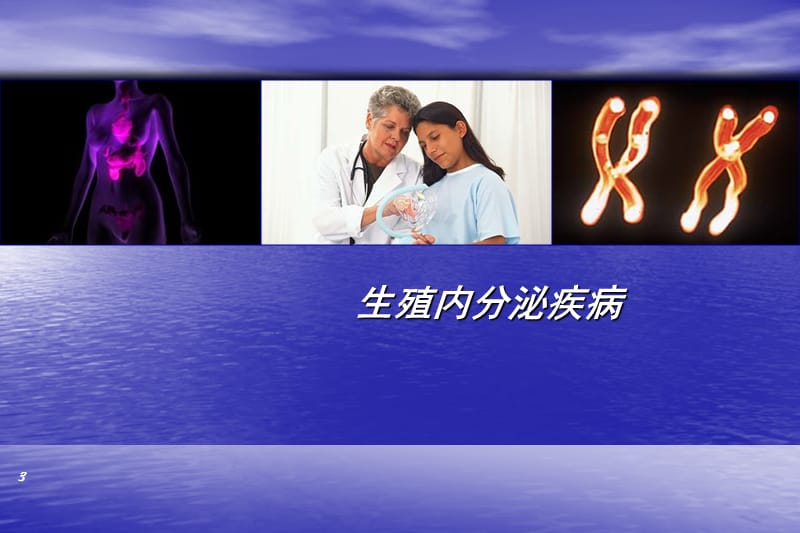 (医学文档)功能失调性子宫出血医学PPT_第3页