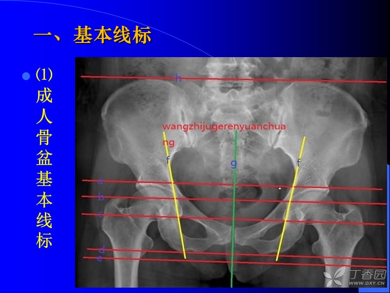 骨盆X线片PPT精品医学课件_第2页