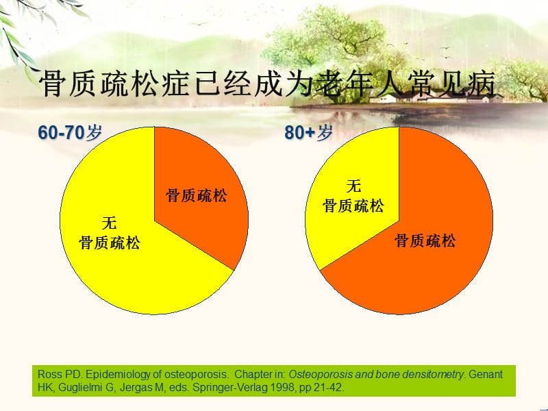 (医学课件)骨松与疼痛ppt演示课件_第2页