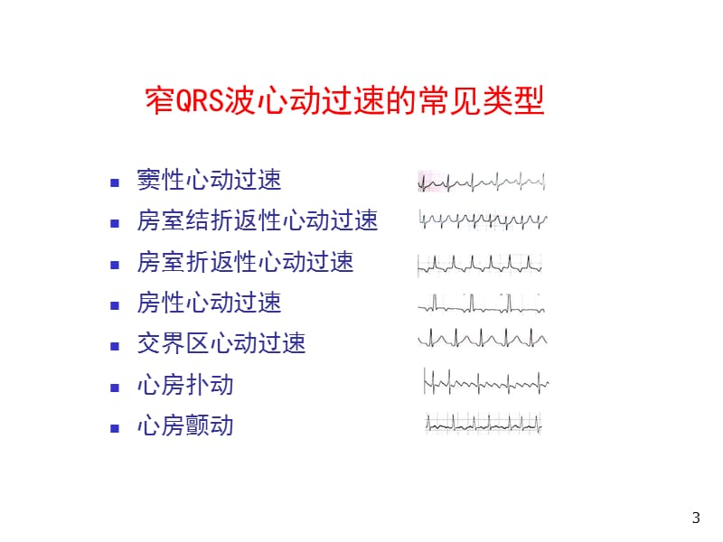 窄QRS波心动过速的急诊处理PPT课件_第3页