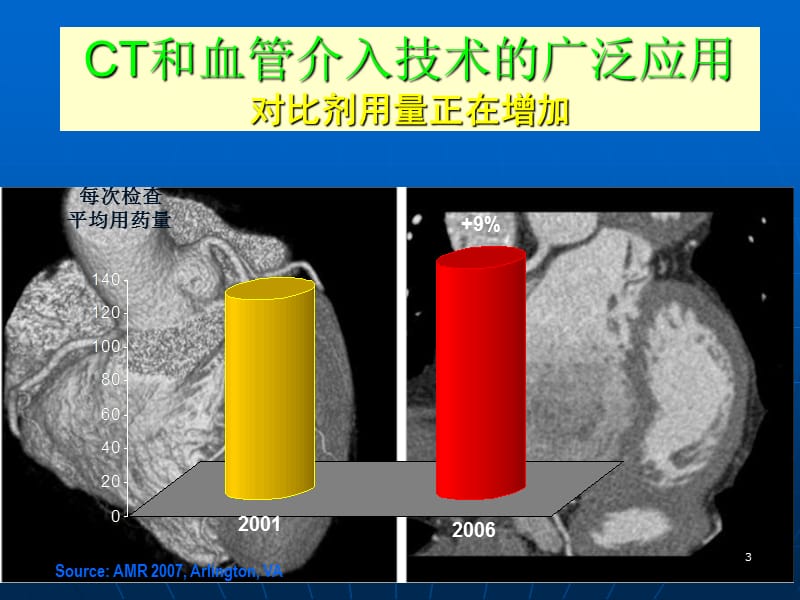 对比剂肾病ppt课件_第3页