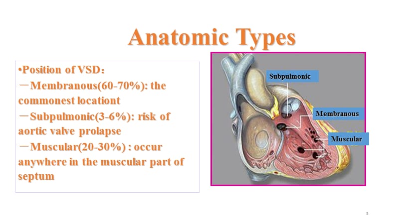 儿童先天性心脏病各论PPT课件_第3页