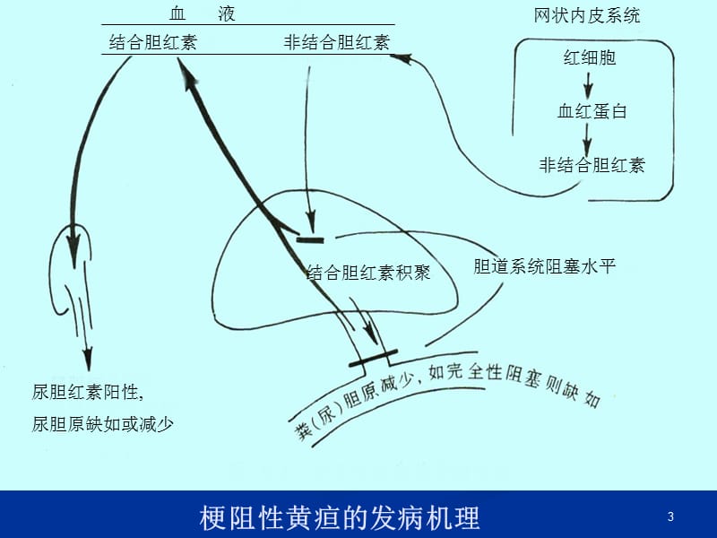 胆汁淤积性疾病ppt课件_第3页