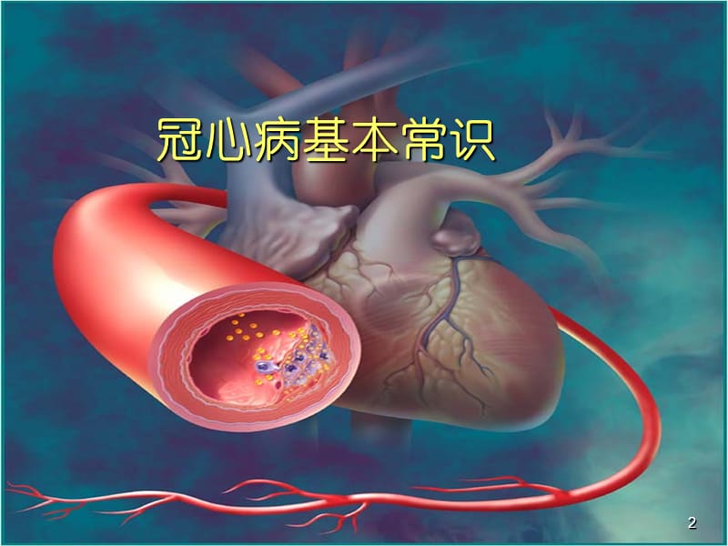 冠心病基本常识及病人的自我保健ppt课件_第2页