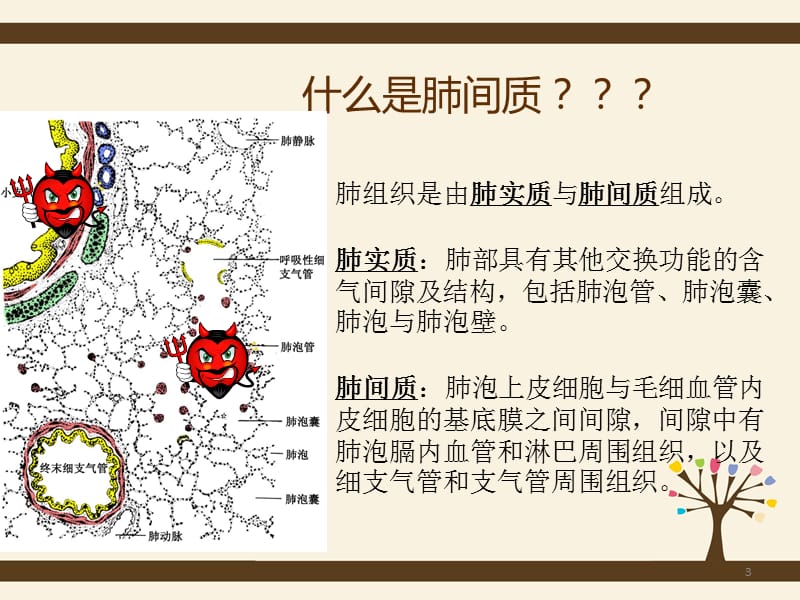 间质性肺炎护理查房PPT课件_第3页