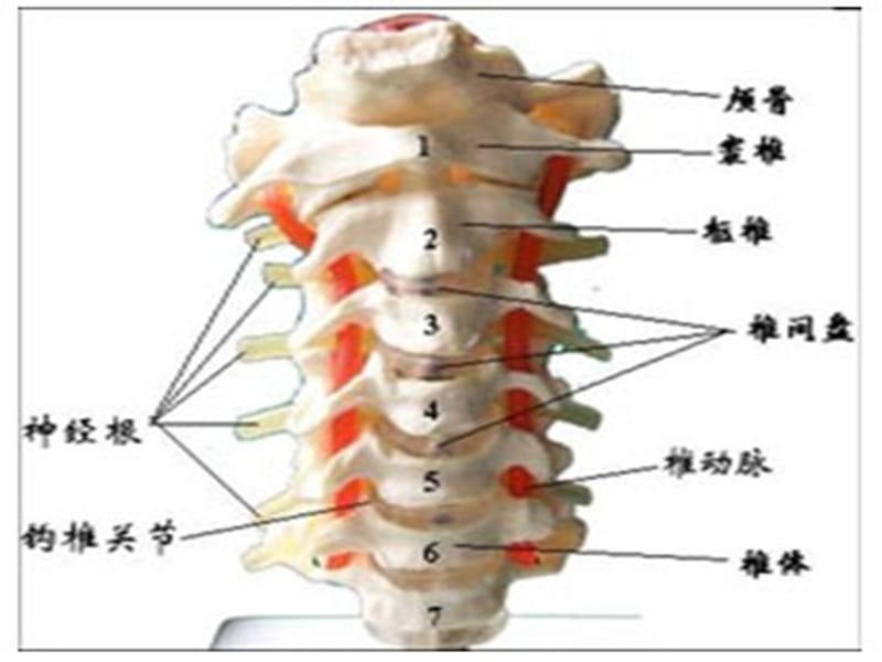 颈椎骨折病人的护理 ppt课件_第3页