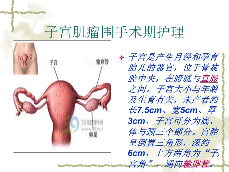 子宫肌瘤围手术期护理ppt课件_第3页