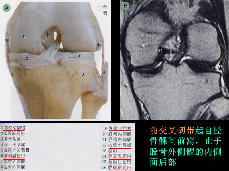 膝关节解剖及MRI诊断ppt课件_第3页