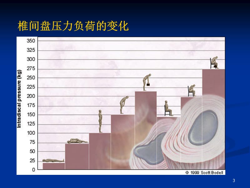 腰椎键盘突出症颈椎病ppt课件_第3页