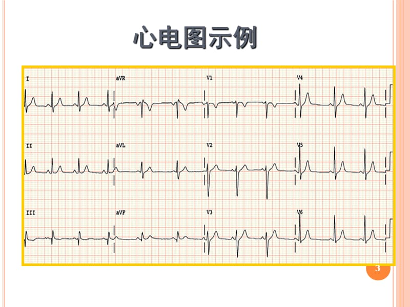 心电图1基础心电图ppt课件_第3页