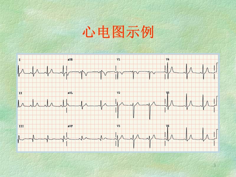 心电图基础ppt课件_第3页