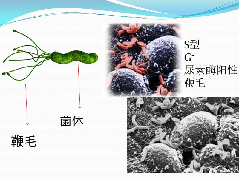 幽门螺杆菌感染ppt课件_第2页