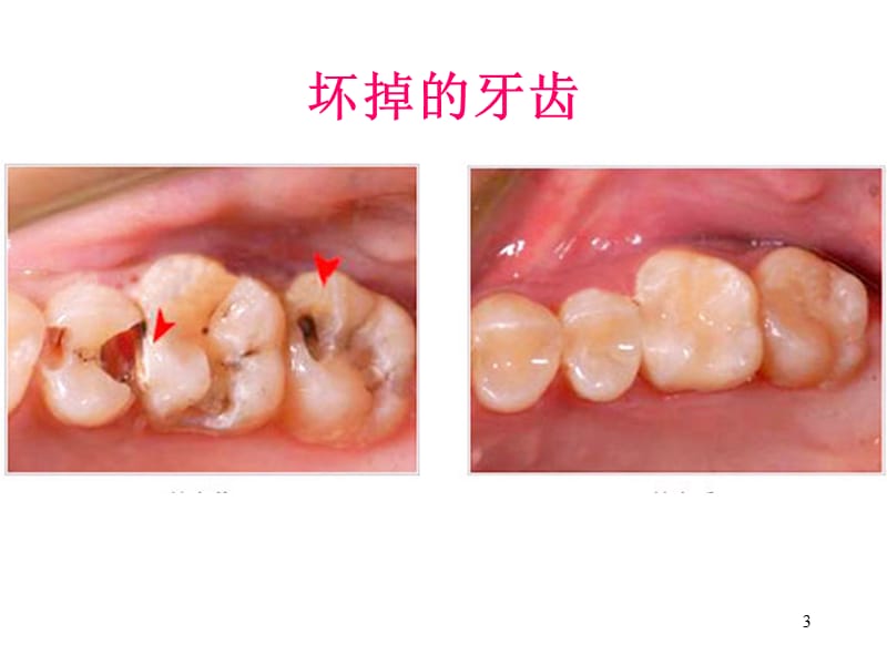 幼儿园中班刷牙ppt课件_第3页