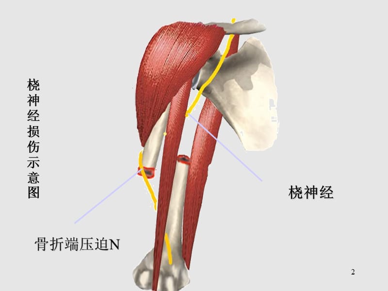 周围神经损伤ppt课件_第2页