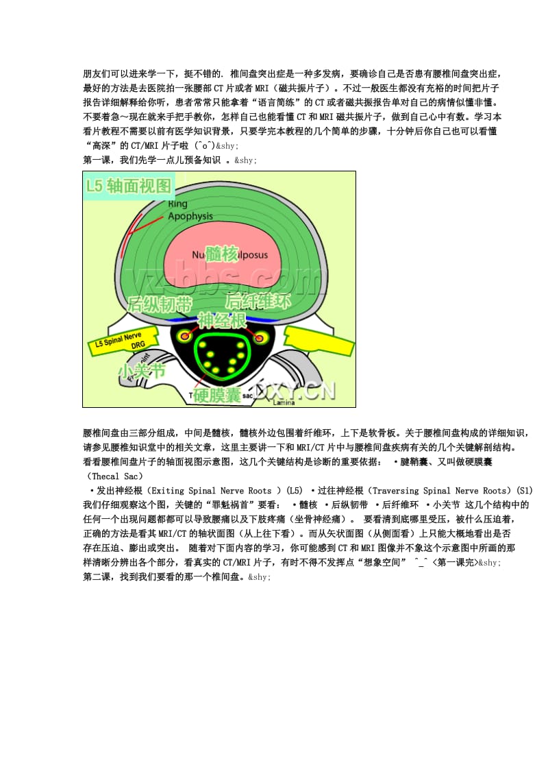 怎样自己也能看懂CT和MRI磁共振片子.doc_第1页