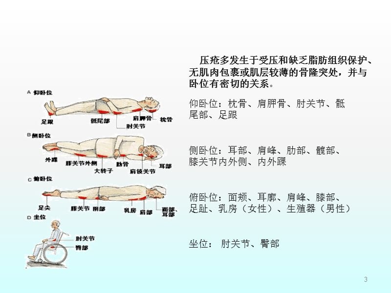 压疮的诊断和护理详解ppt课件_第3页