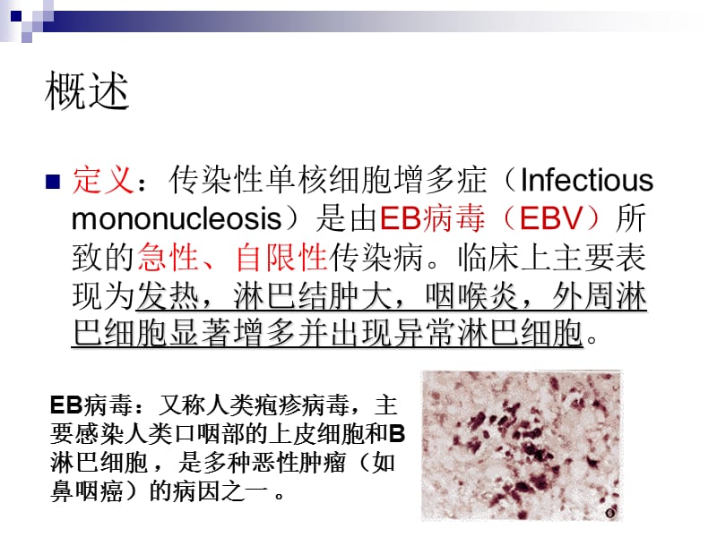 传染性单核细胞增护理查房ppt课件.ppt_第2页
