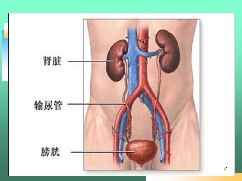 肾癌的护理查房ppt课件_第2页