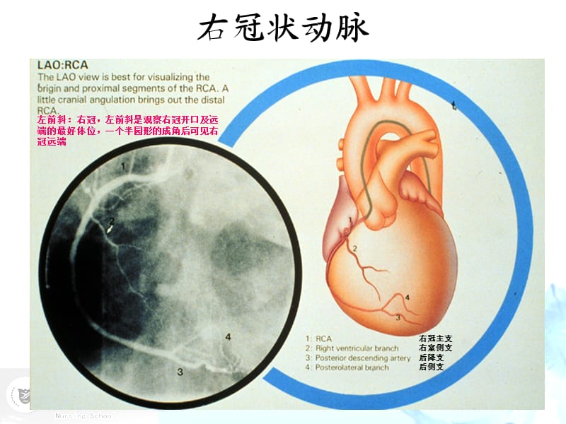 《内科护理学》冠心病病病人的护理.ppt_第3页