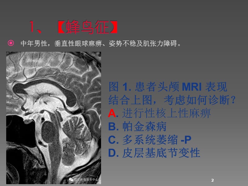 神经系统影像典型征象ppt课件_第2页