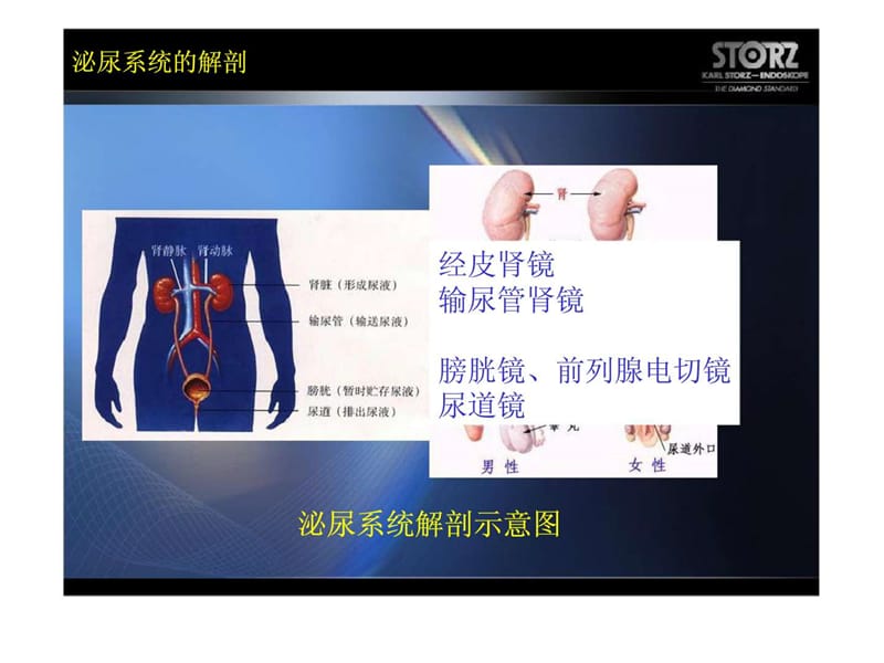 《泌尿科经皮肾镜》PPT课件.ppt_第2页