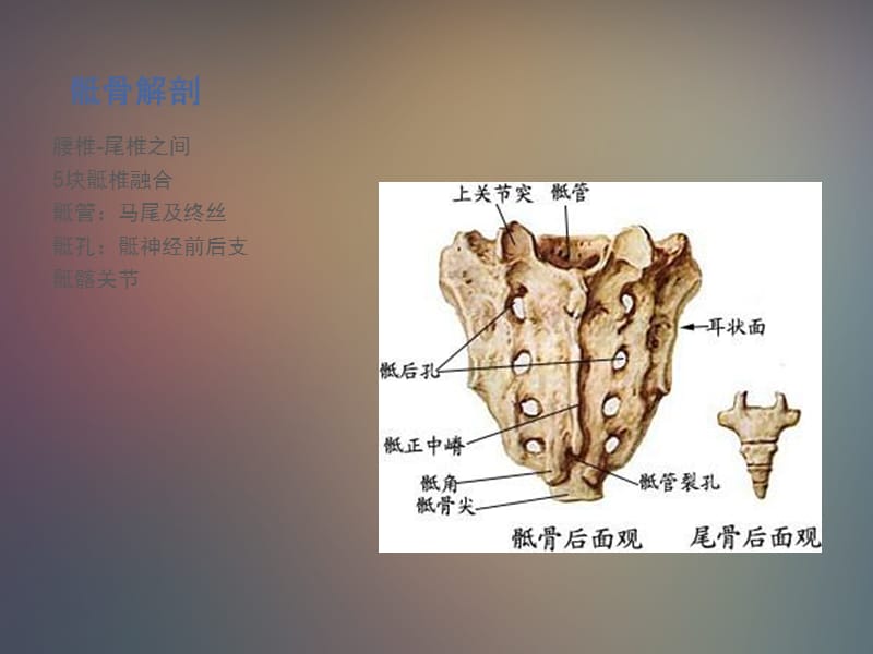 《骶骨肿瘤》PPT课件.ppt_第2页