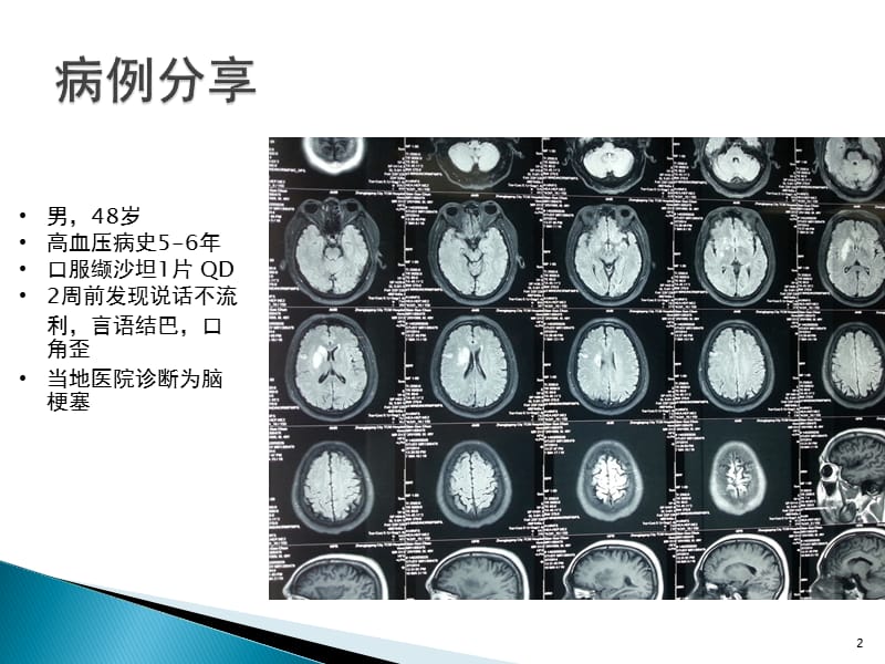 神经外科患者围手术期出血及凝血功能障碍的处理ppt课件_第2页