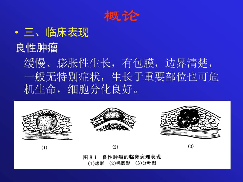 口腔颌面部常见肿瘤课件.ppt_第3页