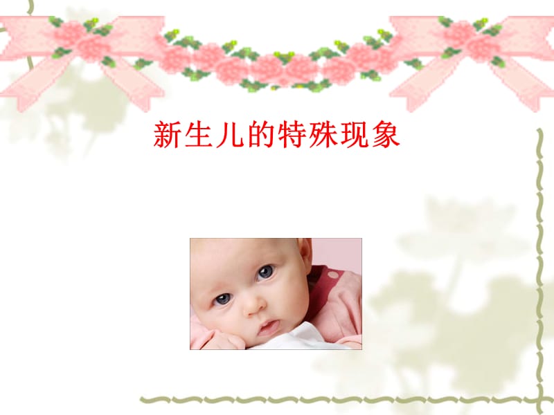 婴幼儿常见问题及护理.ppt_第3页