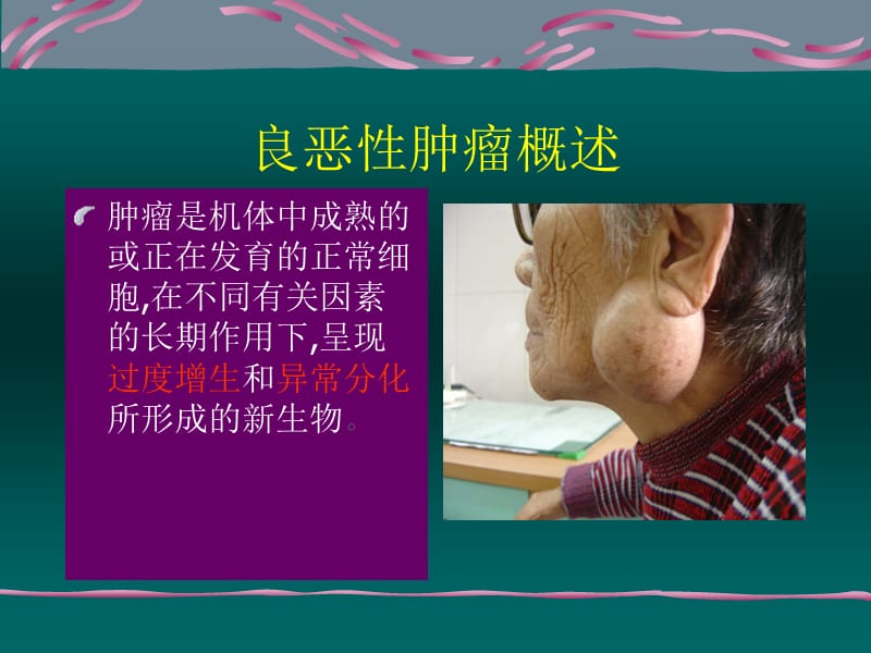 喉癌喉良性肿瘤PPT课件.ppt_第3页