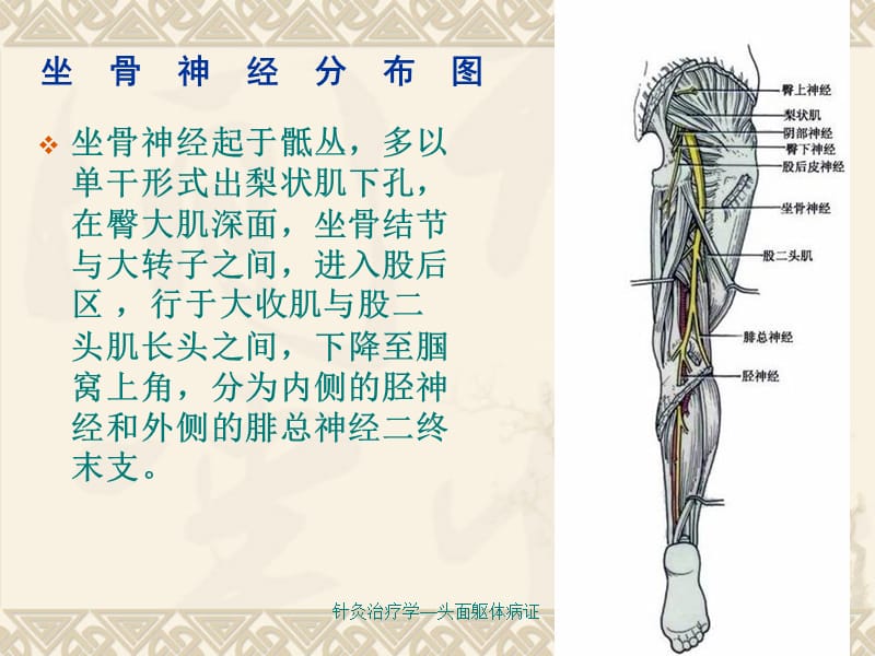 坐骨神经痛针灸培训班学习班ppt课件.ppt_第2页