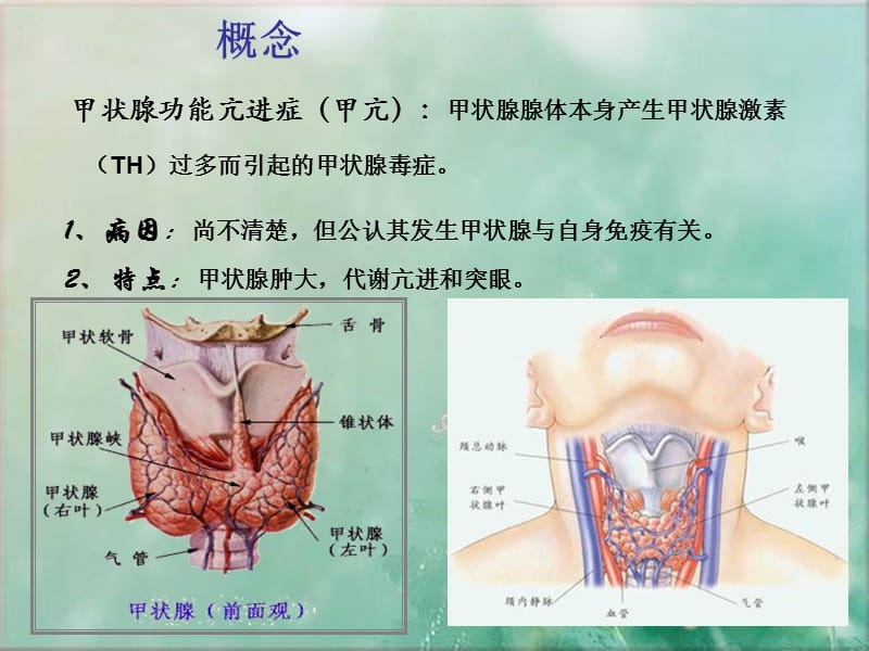 甲状腺功能亢进患者护理查房ppt课件.ppt_第2页