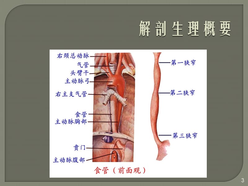 食道癌ppt课件_第3页