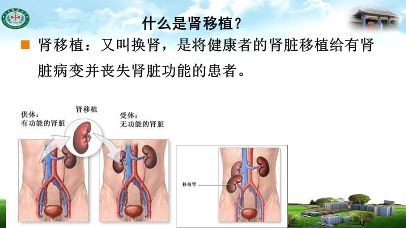 肾移植术后并发症PPT课件.ppt_第2页