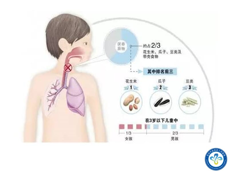 急救知识培训-气道异物的急救PPT课件.ppt_第3页